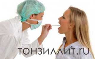 Лечение хронического тонзиллита в домашних условиях и мед. учреждениях