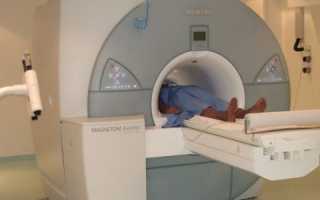 Что такое магнитно-резонансная томография поджелудочной железы, и что она показывает?