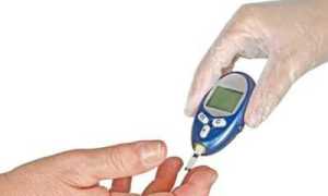 Осложнения при декомпенсированном сахарном диабете, как что делать?