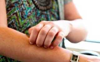 Что такое диабетическая дермопатия?