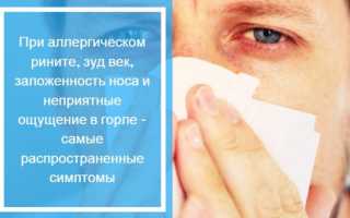 Как вылечить аллергический насморк у взрослых