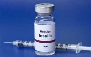 Передозировка Инсулина: Причины и Клиническая Картина. Как Избежать?