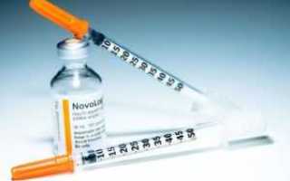 Феномен Сомоджи при сахарном диабете