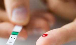 Как повысить сахар в крови: важные советы