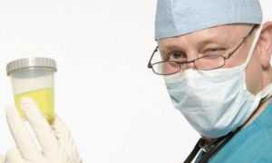 Норма глюкозы в моче анализ на повышенный сахар