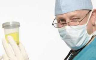 Норма глюкозы в моче анализ на повышенный сахар