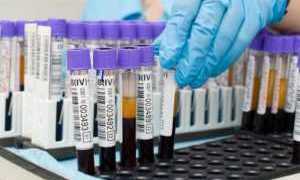 Анализ крови на глюкозу