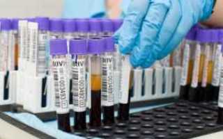 Анализ крови на глюкозу