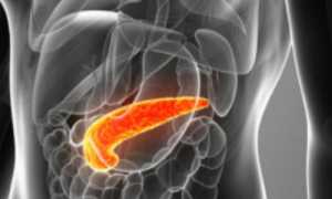 Классификация видов и форм острого панкреатита