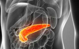 Классификация видов и форм острого панкреатита