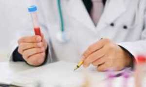 Нормальный уровень инсулина в крови повышенные и пониженные значения