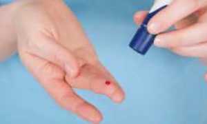 Нарушение толерантности к глюкозе