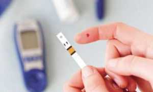 Симптомы и профилактика сахарного диабета