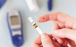 Симптомы и профилактика сахарного диабета