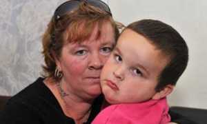 Как выглядят признаки гигантизма у детей на фото?