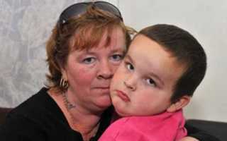 Как выглядят признаки гигантизма у детей на фото?