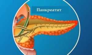Чем опасен панкреатит и какие могут быть последствия?