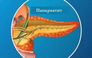 Чем опасен панкреатит и какие могут быть последствия?