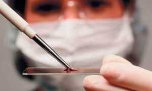 Обозначение глюкозы в крови при анализе