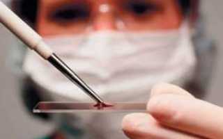 Обозначение глюкозы в крови при анализе