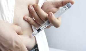 Какой уровень инсулина считается нормальным для здорового человека