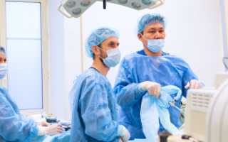 Продольная резекция желудка: Сущность, Показания и Ожидания