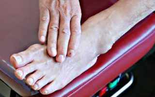 Как изменяются ногти при сахарном диабете?