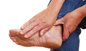 Диабетическая стопа: причины, признаки и лечение