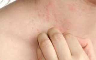 Бывает ли зуд при сахарном диабете и как от него избавиться