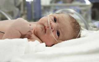 Сахарный диабет у новорожденных детей