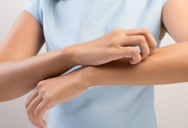 Чешется рука