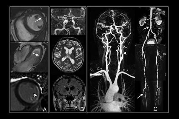 МРТ с контрастом