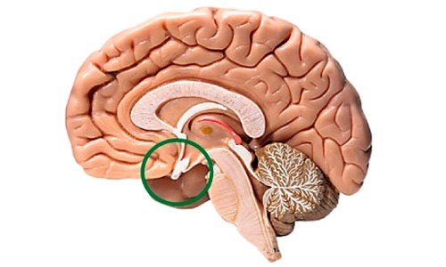 Аденома гипофиза в мозге