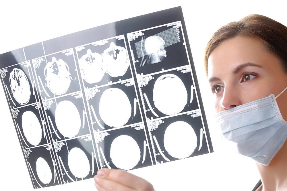 Снимки кисты мозга