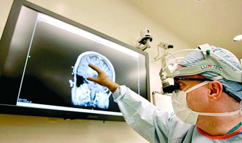 Мозг на экране