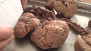 Настоящий продолговатый мозг