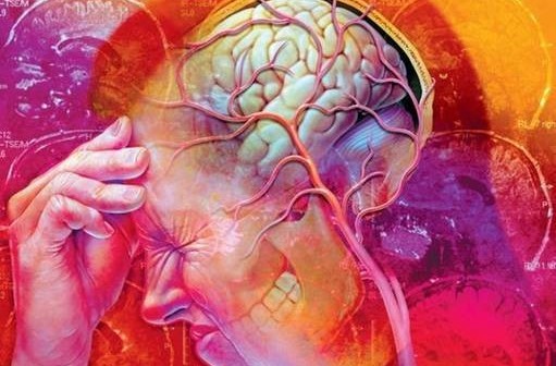 Боль в голове