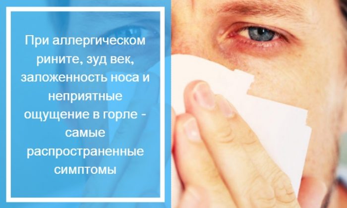 Зуд век