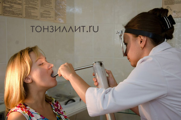Криолечение миндалин