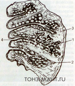 Крипты, или лакуны миндалин (в разрезе)