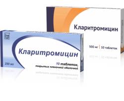 лечение