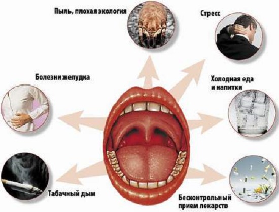 причины хронического фарингита
