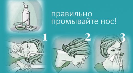 техника промывания носа