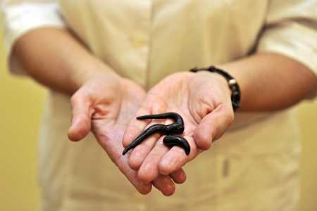 Мужчина держит пиявок Мужчина держит пиявок