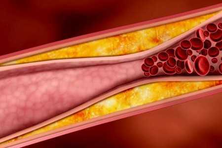 Кровь в сосуде Кровь в сосуде