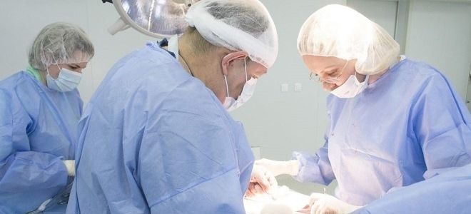 Методика проведения лапароскопии при панкреатите: показания и технология проведения