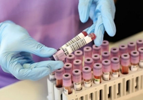 анализ крови