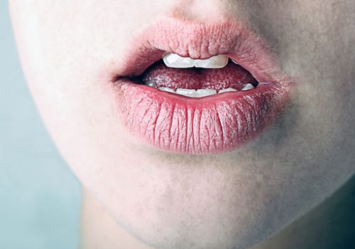 сухость во рту