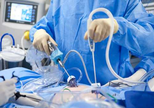 лапораскопия