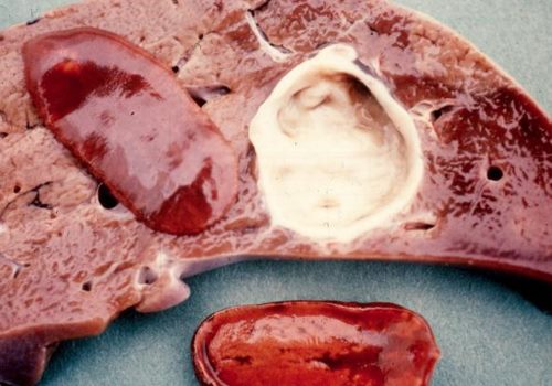 кошачья двуустка в протоках печени